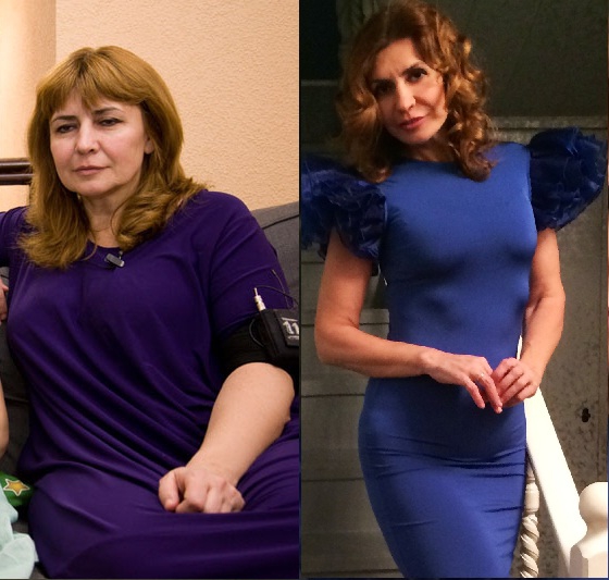 Ирина Агибалова до и после пластических операций