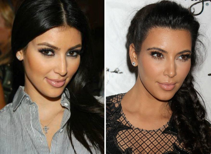 Ким Кардашьян до и после коррекции носа
