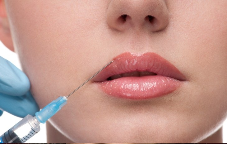 Увеличение тонких губ с помощью инъекций