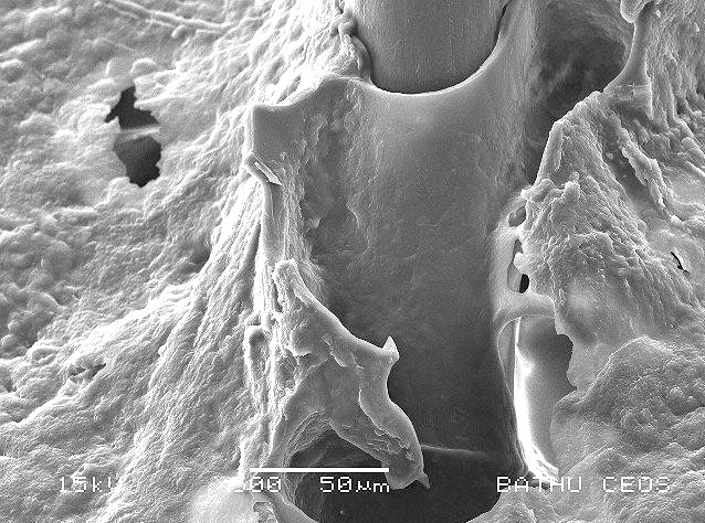 Перхоть на коже: вид под микроскопом
