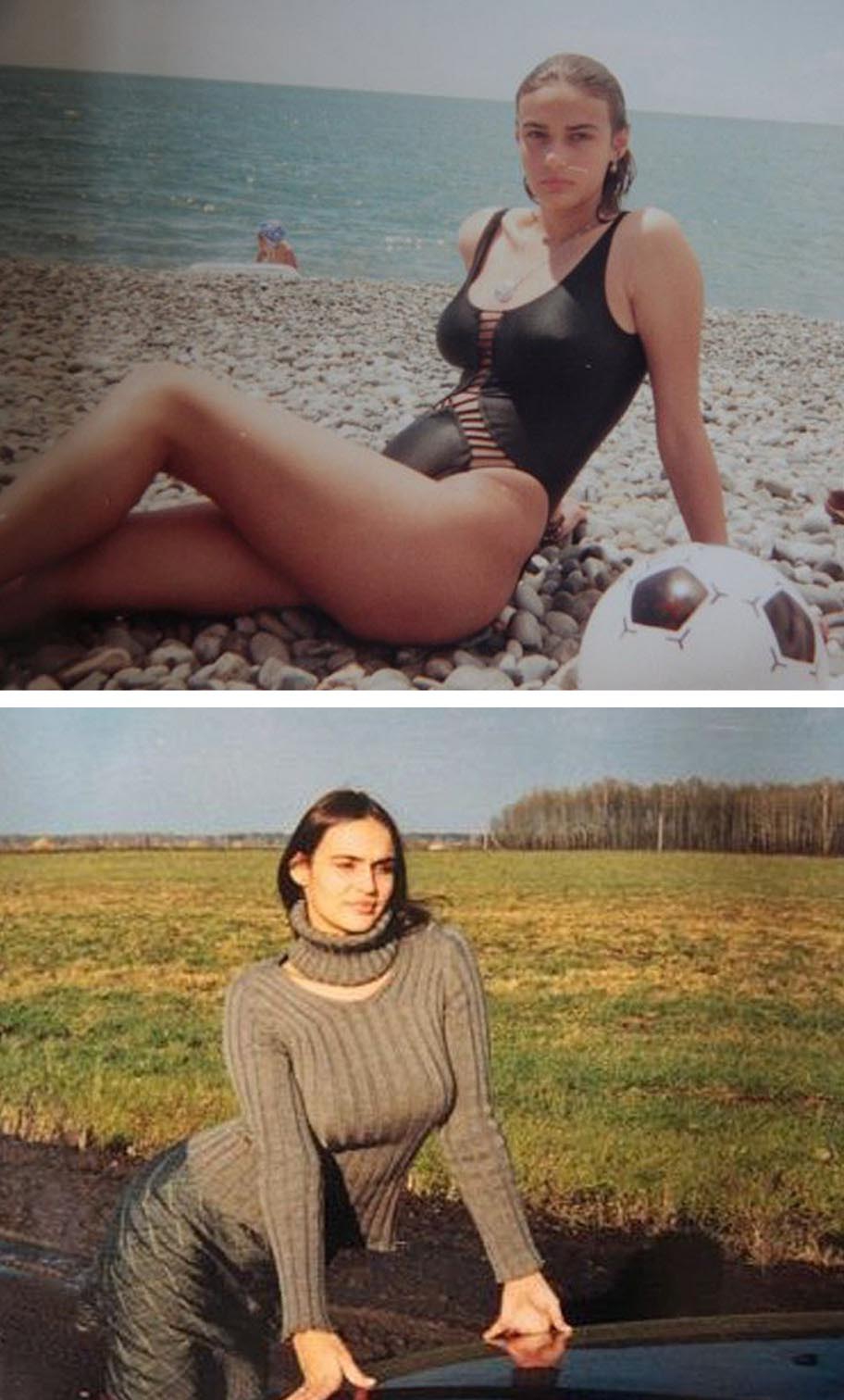 Алена Водонаева до и после пластики, фото телеведущей
