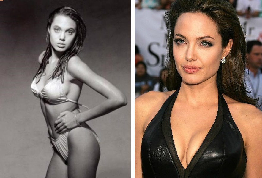 Анджелина Джоли грудь до и после. 