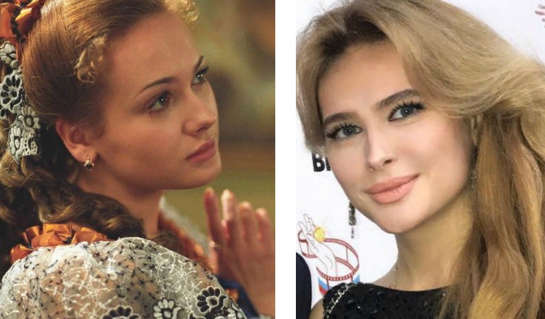 Актриса горшкова до и после пластики фото