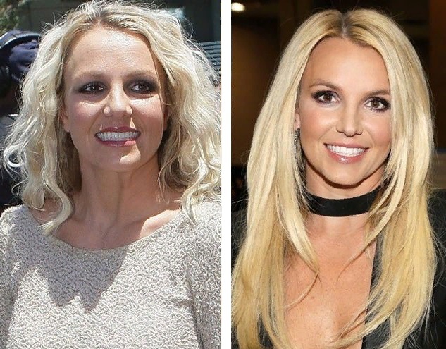 Бритни Спирс до и после пластики носа