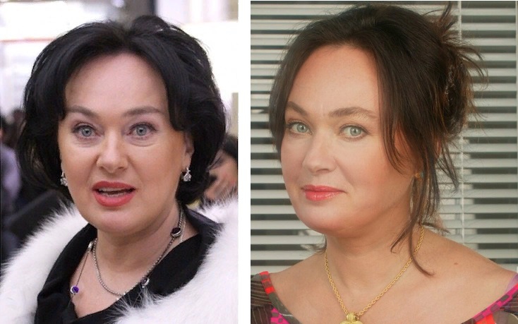 Сравните фото Ларисы Гузеевой до и после блефаропластики