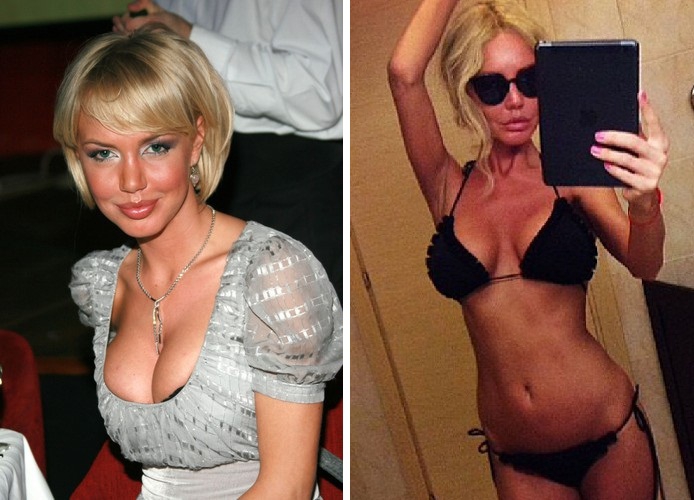 Маша Малиновская до и после пластики груди