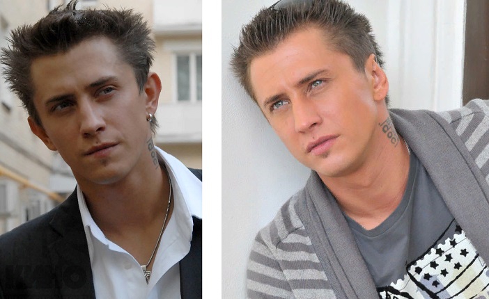Павел прилучный операция на уши фото до и после