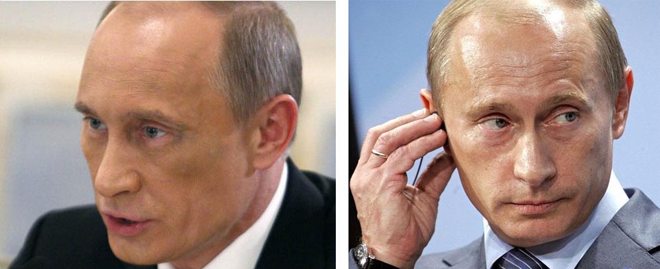 На фото заметны синяки, позволившие предположить, что Путин сделал пластическую операцию
