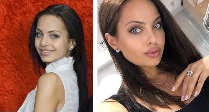 Ассоль жена st до и после операции фото