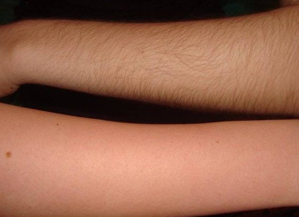 Депиляция воском рук: фото до и после процедуры