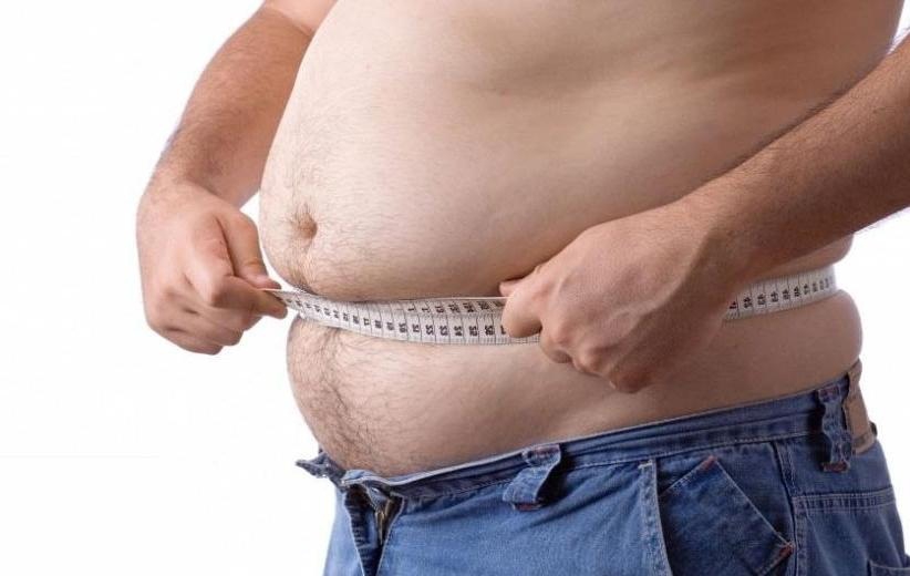 Абдоминальное ожирение у мужчины