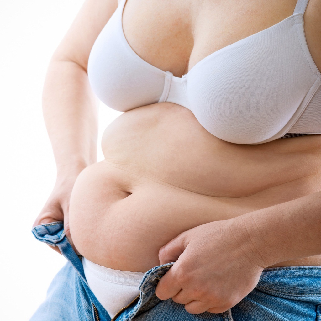 Абдоминальное ожирение у женщины