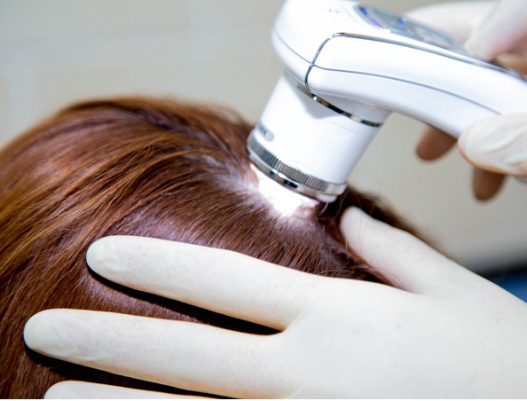 Трихоскопия – исследование, позволяющее определить параметры роста волос в определенных областях волосистой части головы